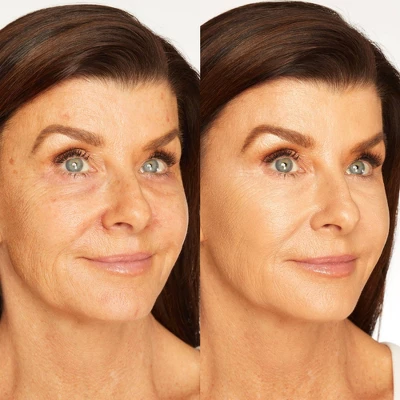 Tarte Shape Tape Radiant Concealer - 35H Medium Honey - 0.33oz - Ulta Beauty 2 Tarte Shape Tape Radiant Concealer - 35H Medium Honey - 0.33oz - Ulta Beauty - Image 2